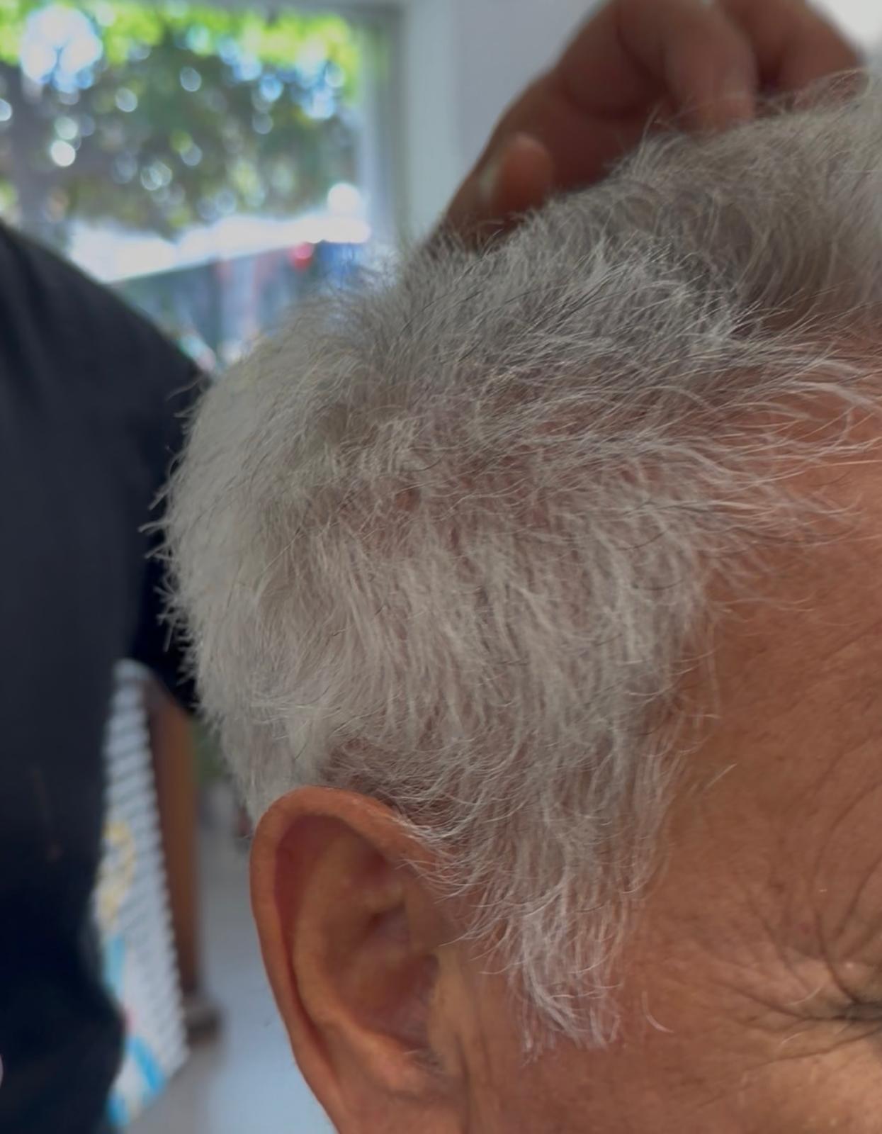 Prima dell'applicazione